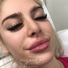 195 vind-ik-leuks, 9 opmerkingen