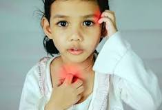 Image result for icd 9 code for acute allergic reaction
