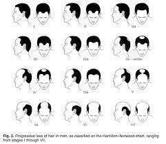 This isn't to say that someone outside of these ages can't also suffer from hair loss, but its just not as common. Reversing Age Related Hair Loss And Restoring Healthy Hair Growth In Men And Women Nutrition Review