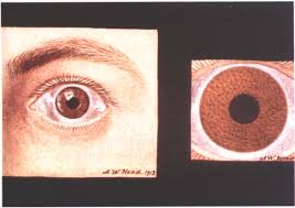 Image result for melanosis sclera