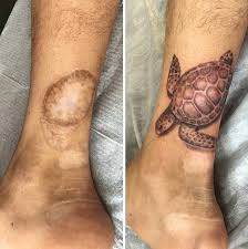Mole Birthmark Tattoo Cover Up Pin On Art Tattoo