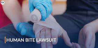 Image result for Human Bite