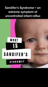 What Does Baby Acid Reflux Sound Like