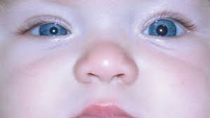 When Anisocoria Signals A Bigger Problem Children S Hospital Of Philadelphia
