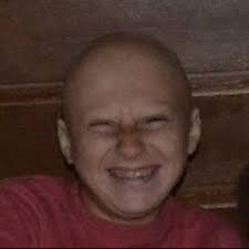 Kaleigh O'Donnell's fundraising page for National Alopecia Areata Foundation