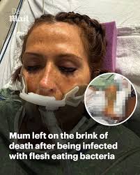 She was quickly rushed to the emergency room and diagnosed with septic  shock and went into organ failure. Read more: https://trib.al/iWE7llT