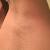 Hair Growth After Waxing