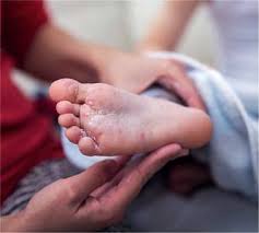 Hand Fuss Mund Krankheit Hoch Ansteckend Aber Harmlos Pta Forum