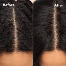 Mizani supreme oil hair treatment, 4.1 oz supreme oil is a luxurious hair treatment formulated with a blend of eight natural oils, plus vitamine. Scalp Care Dry Scalp Conditioner Mizani Sephora