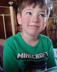 Back when Andy was little (don't you dare point out the obvious) and  straight out the shell, we noticed he would faint when nervous, so he  earned the name Anxiety Annie. Then