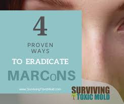 Surviving Toxic Mold Mold Exposure Mold Illness Mold Testing Mold Prevention Toxic Mold And Marcons