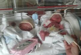 Le schéma vaccinal est renforcé chez les prématurés de moins de 32 sa ou de poids <2kg vaccinés à la naissance. Severine 2012 Seine Et Marne Accouchement Respecte De Jumeaux Mon Corps Mon Bebe Mon Accouchement