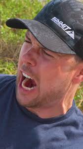 Stung by EVERYTHING! All my worst stings and bites…I need a vacation.  #centipedebite #insectbite #waspsting