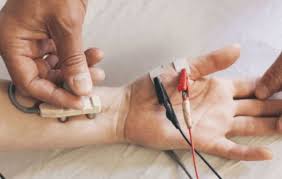 Image result for Nerve Conduction Velocity