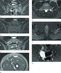 Image result for Incidental Imaging Finding
