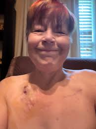 Does anyone have an issue with nausea?