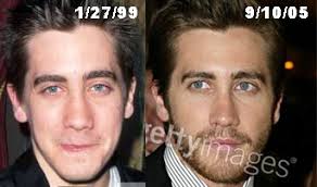 Like female celebrities there are numerous male celebrities who have gone under the knife or needle for altering their appearance. Jake Gyllenhaal Plastic Surgery Nose Lift Or Rhinoplasty