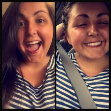 Low zoom settings for clear iris photos