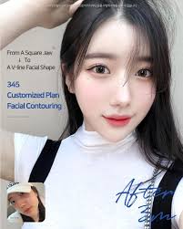 📍𝟯𝟰𝟱 𝗣𝗹𝗮𝘀𝘁𝗶𝗰 𝗦𝘂𝗿𝗴𝗲𝗿𝘆, 𝗦𝗲𝗼𝘂𝗹 . 👨🏻‍⚕️Bone-Contouring  Specialist: Dr. Park Jong Lim ✨ Delicate Custom-Fit Design 🧑🏻‍⚕️ In-house  Anesthesiologist 🎥 CCTV review 🖥️ Leading-edge Safety System . ❤️  𝘊𝘩𝘦𝘦𝘬𝘣𝘰𝘯𝘦 ...