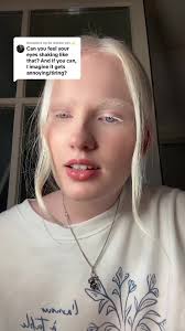 Albino Daddy Long Legs