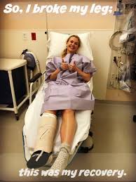 I Broke My Leg This Was My Recovery The Right Fits Broken Ankle Recovery Broken Leg Broken Ankle
