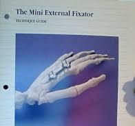 The Mini External Fixator Technique Guide: SYNTHES: Amazon ...