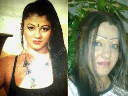 Moving story of former Miss Sri Lanka who got burned while in a sleepover  with her boyfriend