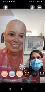 Ladies, I have breast cancer and have therefore lost my hair. But it  doesn't change anything about this person, I wanted to say that we all have  to be friendly to each