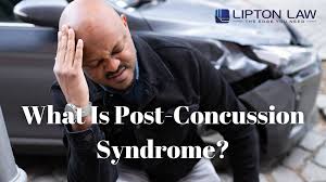 Image result for Postconcussion Syndrome
