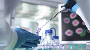 Le diagnostic est fait à l'aide de l'électromyogramme (emg), d'une. Maladies De Charcot Marie Tooth Un Espoir De Traitement