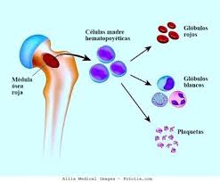 La leucemia mieloide aguda (lma) o leucemia mielocítica aguda es un tipo de cáncer producido en las células de la línea mieloide de los leucocitos, caracterizado por la rápida proliferación de células anormales que se acumulan en la médula ósea e interfieren en la producción de glóbulos rojos normales. Leucemia Mieloide Aguda Sintomas Y Clasificacion