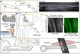 Sarcomere coloring key sarcomere coloring date: Serial Sarcomere Number Is Substantially Decreased Within The Paretic Biceps Brachii In Individuals With Chronic Hemiparetic Stroke Prelights