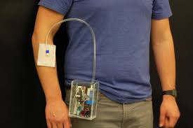 Metal kitchen wall shelves ukrainian city crossword. Wearable Portable Invention Offers Options F Eurekalert