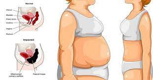 If you're looking to get rid of your bloat fast and get back to feeling great, try our probiotix supplement. Get Rid Of Stomach Bloat Quickly By Making These Small Changes