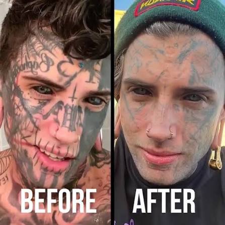 Ethan Bramble has 98% of his body tattooed - but he's now decided to get  laser removal | Hooked On The Look | Facebook