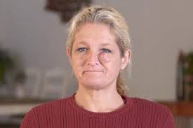 Dr. Pimple Popper's Top Pops: Before-and-After Photos