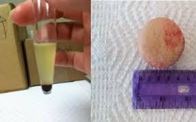 Pin On Interesting Cases