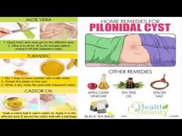 Pin By Easy Health And Beauty Tips Vi On Easy Health And Beauty Tips Videos Pilonidal Cyst Natural Remedies For Allergies Allergy Remedies