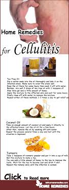 Cellulitis 1 Is An Infection Of The Skin And Subcutaneous Soft Tissue It Occurs When Bacteria Penetrate In The No Cellulitis Remedies Remedies Home Remedies