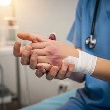 Image result for Hand Fracture