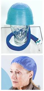 The Challenges of Implementing Design research within SME Based Medical  Product Development: Paxman Scalp Cooling Case Study Ert