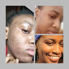 She walked into our clinic with a frown