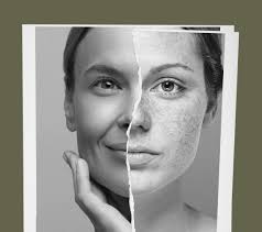 Image result for Freckles