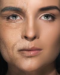 Charlotte Rye (@charlotteryeskin) · Meopham