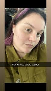 Hi, I'm new to the community and the diagnosis. I started suspecting HEds  around two years ago and was finally diagnosed this year after having  symptoms for my entire life. Currently I'm