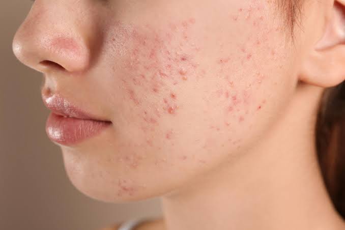 Advanced skin diagnostics at Profrea