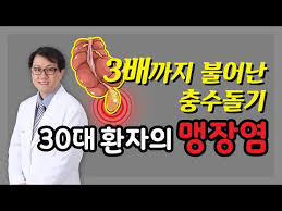 2019년 4월 5일 제주도 롯데호텔에서 개최된 제 52차 대한대장항문학회에서 대항병원 정성엽 과장이 '충수돌기 게실염의 임상적 특성'을 주제로 포스터를. Hd ì¶©ìˆ˜ëŒê¸°ê°€ 3ë°°ê¹Œì§€ ë¶€í'€ì—ˆë‹¤ë‹ˆ 30ëŒ€ í™˜ìžì˜ ë§¹ìž¥ì—¼ ì´ì•¼ê¸°