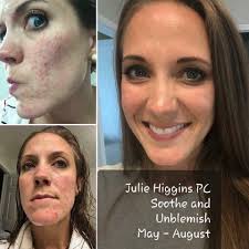 what causes this unappetizing skin sooty mess?