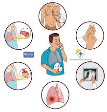 Plamanii sunt parti ale sistemului respirator, localizati in interiorul cutiei toracice, deasupra diafragmului. Medicina Interna Infectiile Acute Ale Cailor Respiratorii Inferioare Rodoctor Medical Center