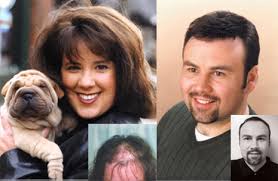 Learn more about the causes and solutions available today. Free Consultation Hair Loss Or Balding Help Denver Metro Area